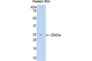 Detection of Recombinant HO1, Mouse using Polyclonal Antibody to Heme Oxygenase 1 (HO1)