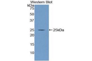Western Blotting (WB) image for anti-Nucleoporin 160kDa (NUP160) (AA 11-206) antibody (ABIN1860078) (NUP160 anticorps  (AA 11-206))