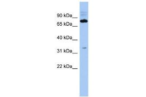 WB Suggested Anti-C14orf44 Antibody Titration: 0. (FAM161B anticorps  (Middle Region))