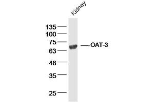 Mouse kidney lysates probed with OAT-3 Polyclonal Antibody, Unconjugated  at 1:300 dilution and 4˚C overnight incubation. (SLC22A8 anticorps  (AA 31-110))