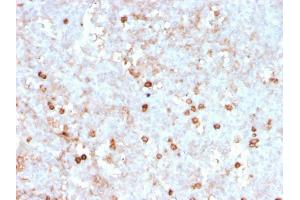 Formalin-fixed, paraffin-embedded human spleen stained with CD14 Recombinant Mouse Monoclonal Antibody (rLPSR/2408).