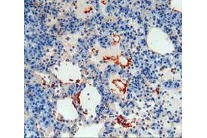 IHC-P analysis of lung tissue, with DAB staining. (Thrombomodulin anticorps  (AA 31-167))