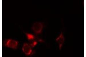 ABIN6275262 staining Hela cells by IF/ICC. (MYOM2 anticorps  (Internal Region))
