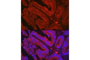 Immunofluorescence analysis of human colon carcinoma using OLFM4 Rabbit pAb (ABIN7269084) at dilution of 1:500 (40x lens).