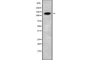 Western blot analysis of CATSPERB using COLO205 whole cell lysates (CATSPERB anticorps  (C-Term))