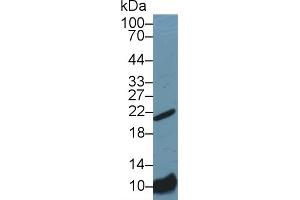 Detection of Bax in Mouse Kidney lysate using Polyclonal Antibody to Bcl2 Associated X Protein (Bax) (BAX anticorps  (AA 1-158))