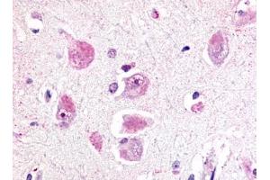 Immunohistochemical staining of Brain (Neurons and glia) using anti- RXFP3 antibody ABIN122238 (Relaxin 3 Receptor 1 anticorps  (Cytoplasmic Domain))