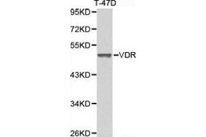 Western Blotting (WB) image for anti-Vitamin D Receptor (VDR) antibody (ABIN1875322)