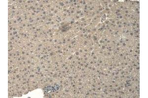 DAB staining on IHC-P; Samples: Mouse Liver Tissue (BNP anticorps  (AA 77-121))