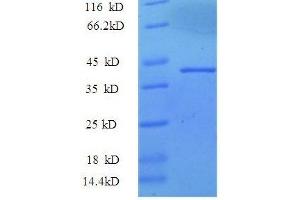 SDS-PAGE (SDS) image for Synuclein, alpha (SNCA) (AA 1-139), (partial) protein (GST tag) (ABIN1046507)