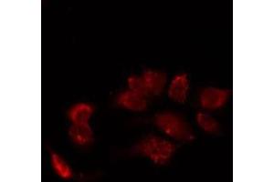 ABIN6277426 staining LoVo by IF/ICC. (PIBF1 anticorps  (C-Term))
