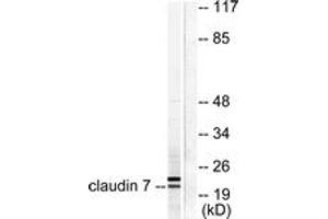 Western blot analysis of extracts from 293 cells, using Claudin 7 Antibody. (Claudin 7 anticorps  (AA 162-211))
