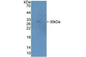 Detection of Recombinant AGA, Human using Polyclonal Antibody to Aspartylglucosaminidase (AGA) (AGA anticorps  (AA 28-245))