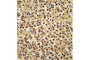 Image no. 3 for anti-SNAIL (SNAI1) (N-Term) antibody (ABIN357449) (SNAIL anticorps  (N-Term))