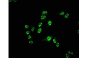 Immunofluorescence staining of Hela cells with ABIN7127412 at 1:55, counter-stained with DAPI.