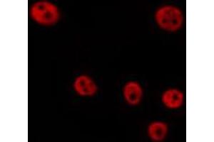 ABIN6268976 staining Hela by IF/ICC.