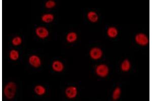 ABIN6266655 staining 293 by IF/ICC.