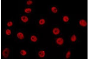 ABIN6266655 staining 293 by IF/ICC. (PIAS3 anticorps  (N-Term))