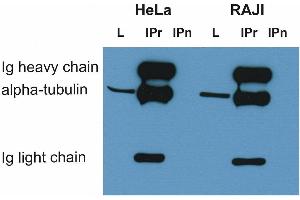 Immunoprecipitation of alpha-tubulin from HeLa and RAJI cell lysate by antibody TU-16 and its detection by antibody. (alpha Tubulin anticorps)