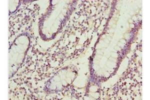 Immunohistochemistry of paraffin-embedded human small intestine tissue using ABIN7143435 at dilution of 1:100 (ADPGK anticorps  (AA 218-497))