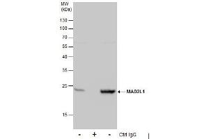 IP Image Immunoprecipitation of MAD2L1 protein from 293T whole cell extracts using 5 μg of MAD2L1 antibody [C2C3], C-term, Western blot analysis was performed using MAD2L1 antibody [C2C3], C-term, EasyBlot anti-Rabbit IgG  was used as a secondary reagent. (MAD2L1 anticorps  (C-Term))