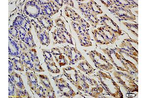 Formalin-fixed and paraffin embedded rat colon labeled with Anti OLFM4 Polyclonal Antibody, Unconjugated (ABIN718046) at 1:200 followed by conjugation to the secondary antibody and DAB staining