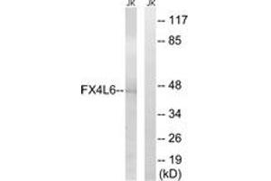 Western blot analysis of extracts from Jurkat cells, using FOXD4/L2/L3/L4/L5/L6 Antibody.