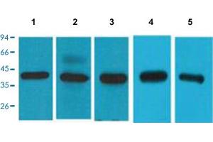 Western Blot analysis of lane 1: 293T cell, Lane 2: HeLa cell, Lane 3: HepG2 cell, Lane 4: mouse brain and Lane 5: rat brain. (EIF4A1 anticorps  (C-Term))