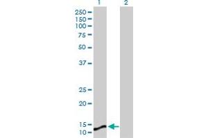 Western Blot analysis of MGST1 expression in transfected 293T cell line by MGST1 MaxPab polyclonal antibody.