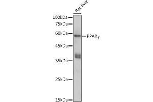 Western blot analysis of extracts of Rat liver, using PPARγ antibody (ABIN6134090, ABIN6146004, ABIN6146006 and ABIN6215096) at 1:1000 dilution. (PPARG anticorps  (AA 70-170))