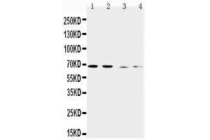 Anti-CAT1 antibody, Western blotting Lane 1: Human Placenta Tissue Lysate Lane 2: HELA Cell Lysate Lane 3: SKOV-3 Cell Lysate Lane 4:  Cell Lysate (SLC7A1 anticorps  (C-Term))