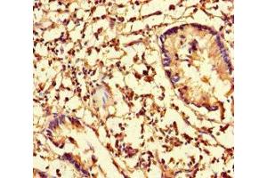 Immunohistochemistry of paraffin-embedded human appendix tissue using ABIN7148044 at dilution of 1:100