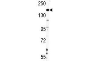 Western blot analysis of Nestin antibody and HepG2 lysate