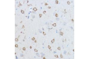 Immunohistochemistry of paraffin-embedded Mouse brain using CCT8 antibody (ABIN1679065, ABIN3018943, ABIN3018944 and ABIN6220637) at dilution of 1:100 (40x lens).