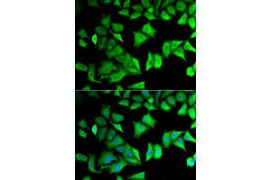 Immunofluorescence (IF) image for anti-Ribosomal Protein S12 (RPS12) antibody (ABIN1980257) (RPS12 anticorps)