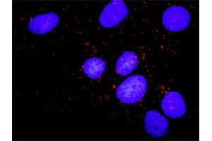 Proximity Ligation Analysis of protein-protein interactions between CCNB1 and PKMYT1.