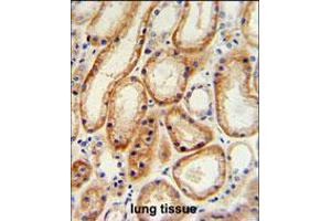 GALNT5 Antibody IHC analysis in formalin fixed and paraffin embedded human normal lung tissue followed by peroxidase conjugation of the secondary antibody and DAB staining. (GALNT5 anticorps  (N-Term))