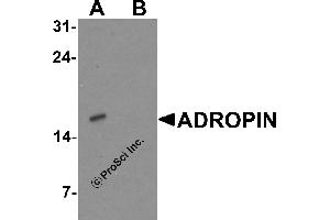 Western Blotting (WB) image for anti-Energy Homeostasis Associated (ENHO) (C-Term) antibody (ABIN2457882) (ENHO anticorps  (C-Term))