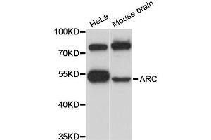 Western blot analysis of extracts of various cell lines, using ARC antibody (ABIN5995970) at 1:3000 dilution. (ARC anticorps)