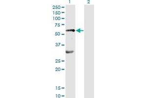 Western Blot analysis of EPOR expression in transfected 293T cell line by EPOR monoclonal antibody (M01), clone 3D10. (EPOR anticorps  (AA 31-130))