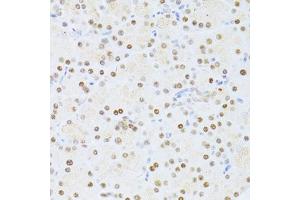 Immunohistochemistry of paraffin-embedded rat pancreas using ETV1 antibody (ABIN6129794, ABIN6140327, ABIN6140329 and ABIN6217250) at dilution of 1:100 (40x lens).