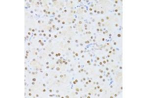 Immunohistochemistry of paraffin-embedded rat pancreas using ETV1 antibody (ABIN6129794, ABIN6140327, ABIN6140329 and ABIN6217250) at dilution of 1:100 (40x lens). (ETV1 anticorps  (AA 80-300))