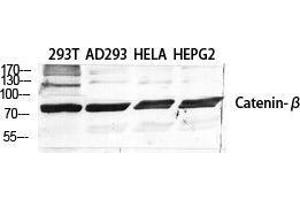 Western Blot (WB) analysis of specific cells using Catenin-beta Polyclonal Antibody. (beta Catenin anticorps  (Ser289))