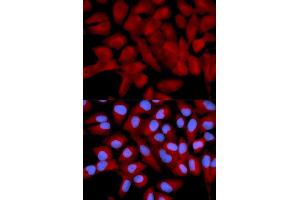 Immunofluorescence analysis of U2OS cell using EIF5A antibody. (EIF5A anticorps  (AA 1-154))