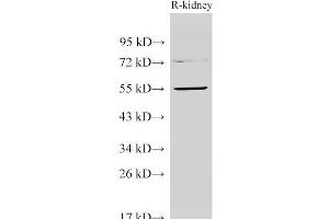 Western Blot analysis of Rat kidney using TGFBR1 Polyclonal Antibody at dilution of 1:1000 (TGFBR1 anticorps)