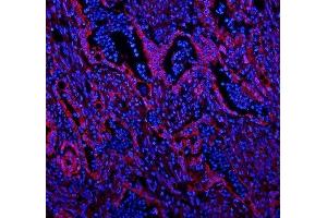 anti-Caveolin 2 (CAV2) (AA 1-162) antibody