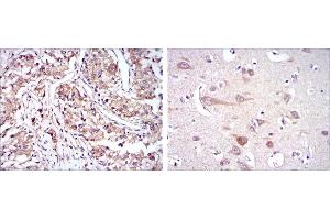 Immunohistochemical analysis of paraffin-embedded kidney cancer tissues (left) and brain tissues (right) using HSP90AB1 mouse mAb with DAB staining.