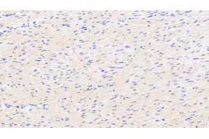 Detection of DKK2 in Human Cardiac Muscle Tissue using Polyclonal Antibody to Dickkopf Related Protein 2 (DKK2)