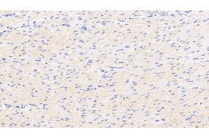 Detection of DKK2 in Human Cardiac Muscle Tissue using Polyclonal Antibody to Dickkopf Related Protein 2 (DKK2) (DKK2 anticorps  (AA 159-258))