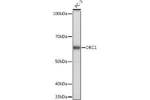 Western blot analysis of extracts of PC-3 cells, using DKC1 Rabbit mAb (ABIN7266869) at 1:1000 dilution. (DKC1 anticorps)